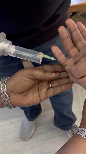 FINE NEEDLE ASPIRATION CYTOLOGY #pathology #science #microscope