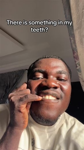 Hopped on this cause my teeth cost 12k dolls #fyp #viral #fyp #viral #relateable #viralvideos #fy #searchbar #trending #fypviral #fypシ゚