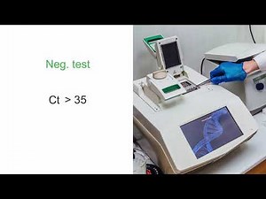 Hydroxychloroquine and azithromycin for the treatment of COVID-19–Review of study by Didier Raoult