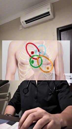 Diagnosis dan Manajemen Mitral Regurgitation