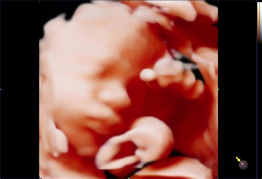 2.5K views | Nana Oo on Reels | Facebook