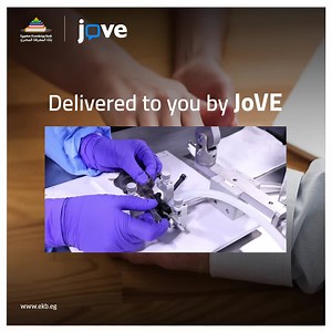 Learn more about Parkinson Disease through watching this analytical video from JoVE through the Egyptian Knowledge Bank: https://bit.ly/3T4iEXk تعرف على المزيد حول مرض باركنسون من خلال مشاهدة هذا الفيديو التحليلي من JoVE من خلال بنك المعرفة المصري: https://bit.ly/3T4iEXk | Egyptian Knowledge Bank- EKB