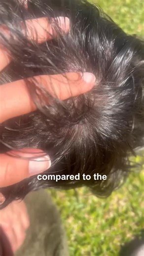 Jorge Fernando on Instagram: "Hairloss Serum Update"