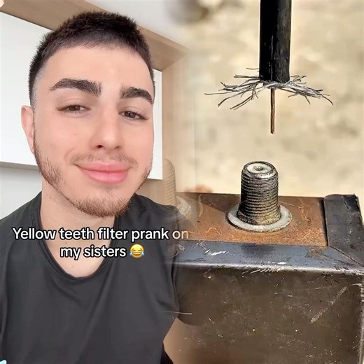 Keemokazi pulls hilarious prank using yellow teeth filter 😂