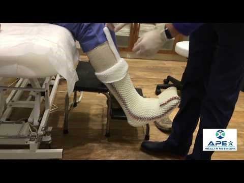 How to apply a total contact cast (TCC-EZ)