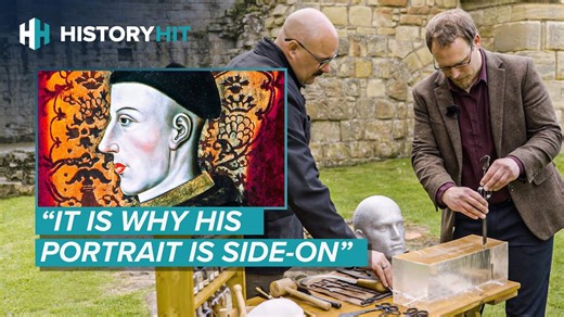 The Miraculous Medieval Surgery That Saved King Henry V’s Life