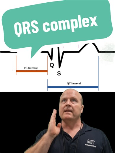 ECG basics- The QRS complex #ecg #qrs