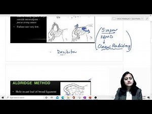 Easy mnemonics - Femal sterilisation techniques | Tubectomy mnemonics : NEETPG Rank booster