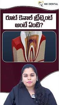 What Is Root Canal Treatment? | Step-by-Step RCT Procedure Explained | MK Dental