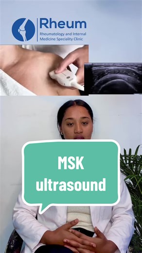 Musculoskeletal Ultrasound Basics: A Comprehensive Guide