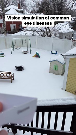 13K views · 281 reactions | Vision Simulation of Common Eye Diseases #vision #simulation #awareness | Blind on the Move | Facebook