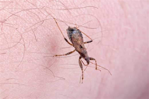 The symptoms of ‘kissing bug’ disease to be on the look out for