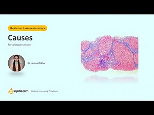 Portal Hypertension | Causes