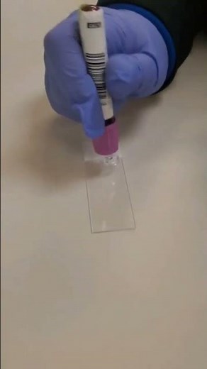 Making a peripheral blood smear | prepare a perfect blood smear | blood film preparation |hematology