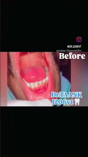 I Tried Every Tobacco Stain Removal Technique