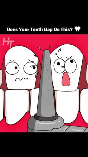 The Hidden Truth Behind Your Tooth Gap! (Watch Before It’s Too Late) 🦷 #shorts