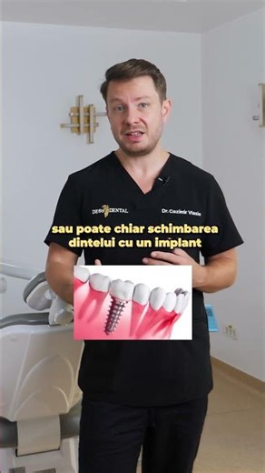 Cât costă o coroană dentară?