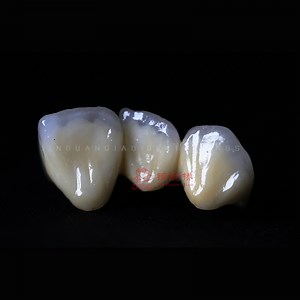 [Hot Item] Dental Material 3D Digital Types of Dental Zircornia Crowns and Bridges for Denture Health