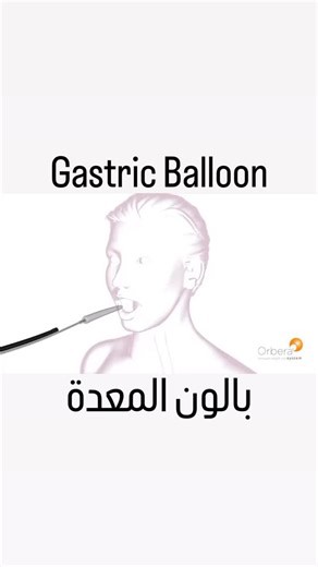 The gastric balloon is a simple, same-day procedure that helps you stay full longer and manage cravings. Learn all the details with Dr. Tarek Saleh, Gastroenterology & Obesity Specialist, Dubai. #gastricballoon #weightlossjourney #drtareksaleh #dubaiweightloss #drtareksalehdubai #uae | Dr.Tareksaleh | Facebook
