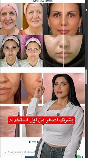جهاز الومينا برو نتايج تشوفيها من اول استخدام