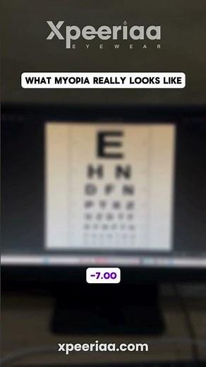 What Myopia REALLY Looks Like 👁️