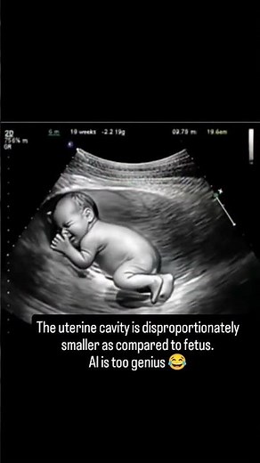 AI Pregnancy Video Showing Big Baby Inside Womb