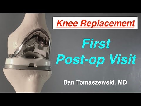 First Post-op Visit after Knee Replacement Surgery