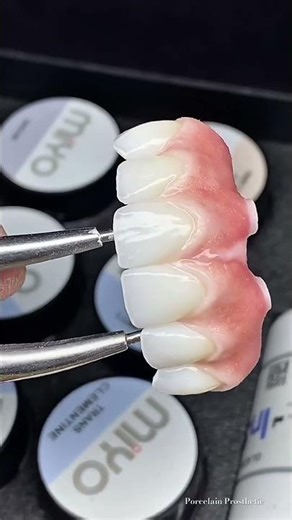 MIYO + Zirconia Crown Transformation | Porcelain Prosthetic