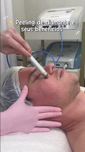 Peeling de Diamante e seus Benefícios ✨