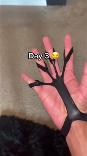 Finger Gripper & Extensor Trainer — Rehab Support for Strong, Independent Fingers