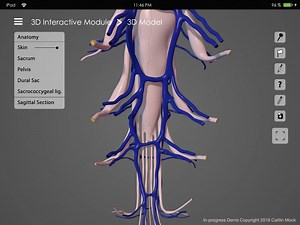 Caudal Epidural Nerve Block Teaching App, In-progress Demo