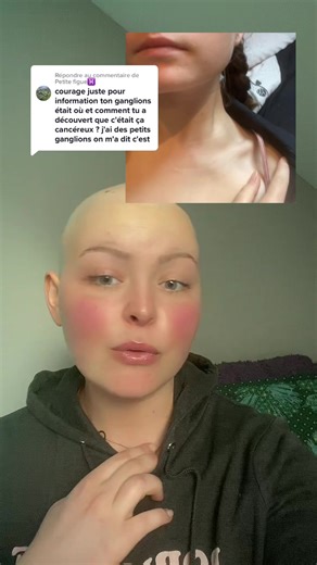 Comprendre le lymphome hodgkinien et les ganglions lymphatiques