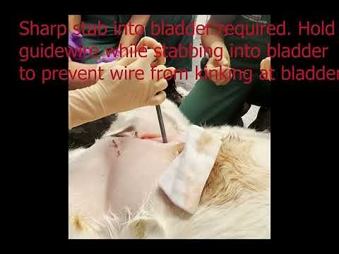 Percutaneous Tube cystostomy video