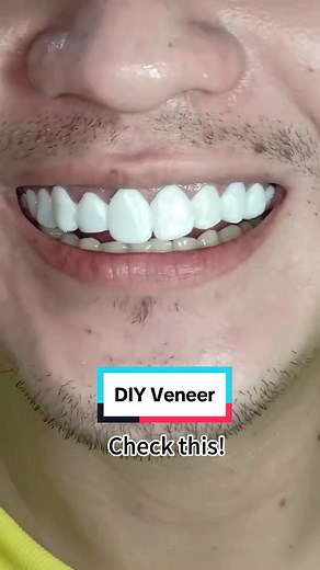 How to Make Perfect False Teeth at Home