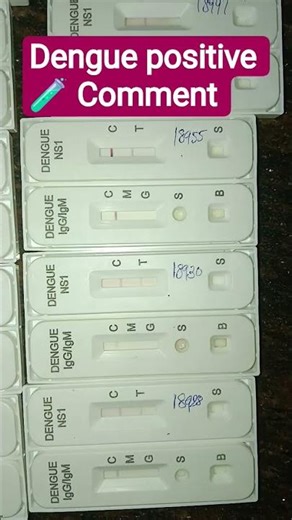 Dengue Test 🧪💉 #medical #doctor #dengue # pathology