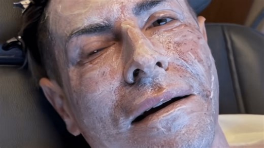 X Factor star looks unrecognisable with after gruesome treatment shocks fans