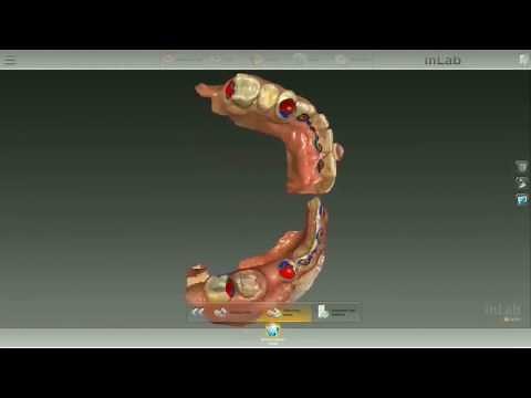 Sirona Connect: Datenempfang im Labor