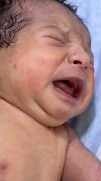 Blue Baby? How to Recognize & Respond to Cyanosis in Newborn! #acrocyanosis #bluebaby