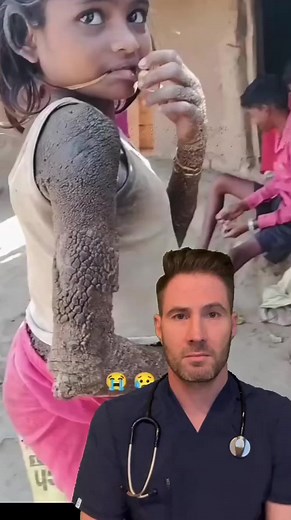 The smell of rubbing alcohol may help with nausea #nausea #vomiting #hungover #doctor | Mary Johnson