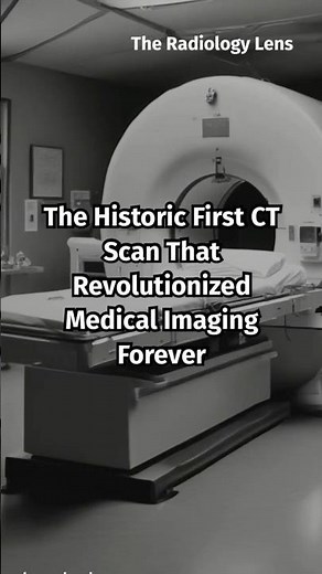 First ever CT Scan and history behind it #ctscan #radiology #medicalimaging #xray #theradiologylens