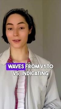 MCQ Q&A Decoding R Wave Progression