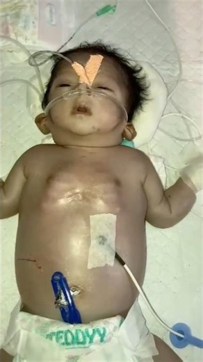 Newborn Critical Condition | बच्चे की हालत गंभीर क्यों होती है? #explore