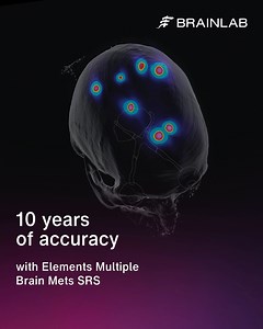 Celebrating 10 years of Elements Multiple Brain Mets SRS 🌟🔟 For the past decade, clinicians have relied on RT Elements to rapidly generate highly accurate, efficient radiosurgery plans for multiple brain metastases treatments. 🧠 Brainlab pioneered a single-isocenter radiosurgery treatment solution for multiple brain metastases on linacs, transforming the way care is delivered. More than 5,000 patients are treated each year using Elements Multiple Brain Mets SRS. With Elements Retreatment Revi