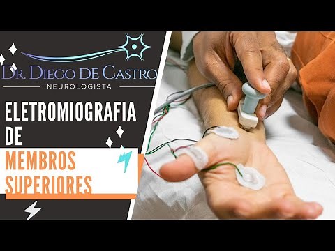 Electromyography of the Upper Limbs (UL) | Dr Diego de Castro Neurologist