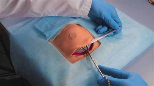 Operating Room Insights: The Truth Behind the Procedure | 5-Minute Crafts Family