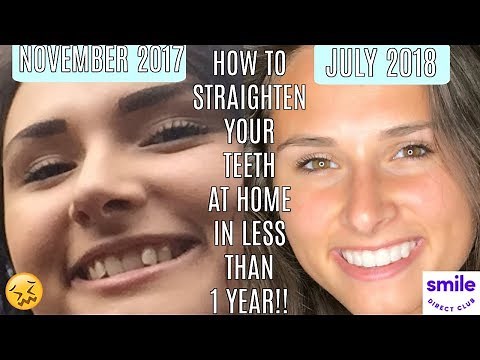 How to Straighten Your Teeth at Home in Less Than 1 Year!! | Makayla Shaw
