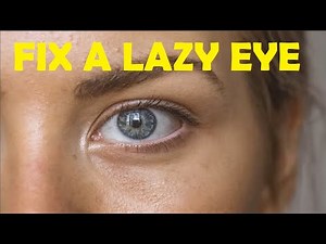 how to fix a lazy eye without surgery at home