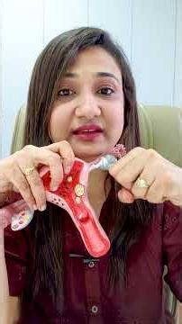 PREGNANCY ना रुकने का प्रमुख कारण | How to conceive pregnancy fast ? #drpriyankayadav