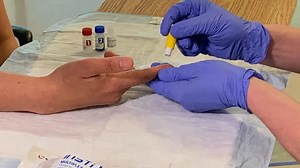 New syphilis rapid test could slow disease’s spread, doctors say