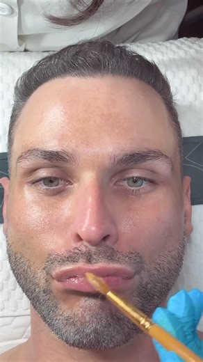 LIP MASK – HYDRATION The skin on the lips is thinner and more delicate than anywhere else on the face, it has no oil glands and fewer protective layers, making it more vulnerable to dryness, cracking, and environmental damage. Exposure to the sun, cold, or dehydration quickly causes the lips to lose moisture and volume. A professional hydrating lip mask restores softness, plumpness, and elasticity by infusing the skin with nourishing ingredients like hyaluronic acid, collagen, and vitamins. Hydr